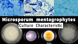 Trichophyton mentagrophytes culture Characteristic [upl. by Zorine]