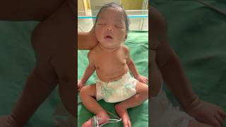 Cerebral palsy Baby\please Praynicu medical baby viral [upl. by Baryram]