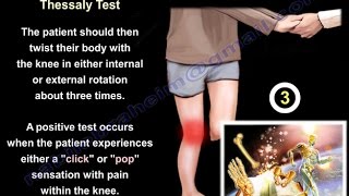 Meniscal Tears Examination amp Tests  Everything You Need To Know  Dr Nabil Ebraheim [upl. by Teerprah]