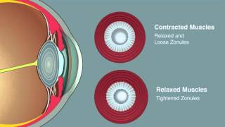 Lens Accommodation [upl. by Noli]