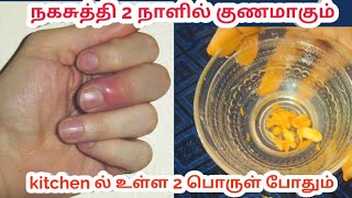 Red big finger  how to cure paronychia at home treatment  naga suthi remedy நகசுத்தி சரியாக [upl. by Alial]