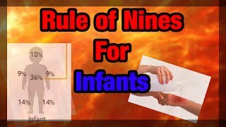 The Rule of Nines Explained Infant Version [upl. by Sexela681]