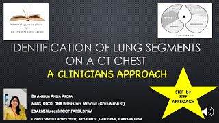 How To Read a CT chest  LUNG SEGMENT Identification [upl. by Acnaiv]