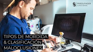 Tipos de mordidas dentales y clasificación de maloclusiones [upl. by Way714]