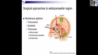 Gaucher disease  causes symptoms diagnosis treatment pathology [upl. by Ellennahs]