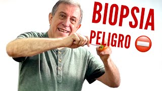 Peligros de la biopsia de próstata [upl. by Eiffub]