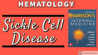 SICKLE CELL DISEASE  Clinical Features  Diagnosis  Treatment  Harrison [upl. by Liam]