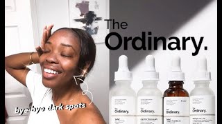 The Ordinary  5 BEST Products for Hyperpigmentation Dark Spots Oily  AcneProne Skin 2020 [upl. by Anneehs]