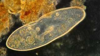 Paramecium Feeding Magnified 400X High Definition [upl. by Nana482]