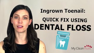 Ingrown Toenail A Quick Fix With Dental Floss [upl. by Nessa471]