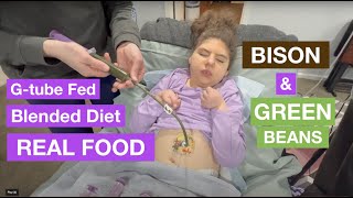 Blended Diet Recipe for Gtube  Bison amp Green Beans [upl. by Dobson]