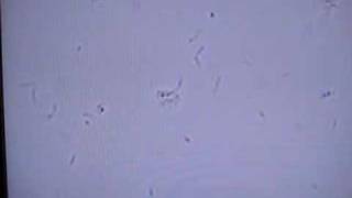 Listeria with tumbling motility [upl. by Ahsiad27]