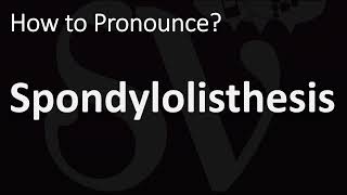 How to Pronounce Spondylolisthesis CORRECTLY [upl. by Letnuhs38]