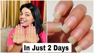 How to grow your nails in 2 days  Long amp Strong Nails [upl. by Tenaej]