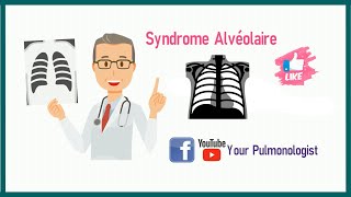 Série Radio  Syndrome alvéolaire de A à Z [upl. by Assirral]