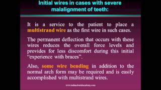 leveling amp aligning in orthodontics  fixed orthodontic courses by Indian dental academy [upl. by Eitsirk]