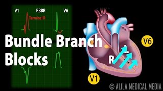 Intro to EKG Interpretation  AV Block [upl. by Eirrol]