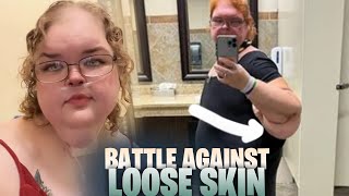 Tammy Slatons 1000lb Sisters The Struggle with Loose Skin After 31st Weight Loss [upl. by Sara-Ann198]