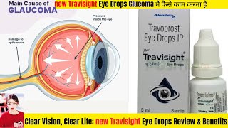 NEW TRAVISIGHT Eye Drop Review amp Glaucoma Management thepharmacistdrx travisighteyedroops [upl. by Ayala]