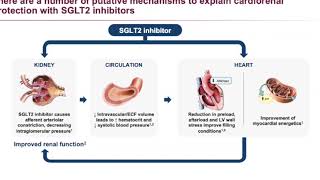 Clinical judgement and cardiac biomarkers with MD James Januzzi [upl. by Schnell220]