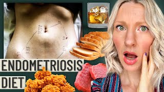 The Truth About The Endometriosis Diet This is your warning sign [upl. by Kerstin847]