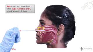 Collection of Oropharyngeal OP Nasal MidTurbinate NMT or Nasopharyngeal NP swab [upl. by Letney939]