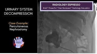 URINARY SYSTEM DECOMPRESSION  Case Example  PERCUTANEOUS NEPHROSTOMY TUBE PLACEMENT [upl. by Ecyor]