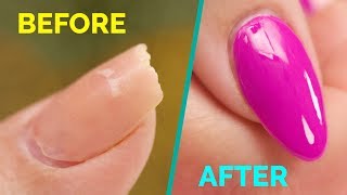 How to Fix A Broken Nail Fast [upl. by Lally]