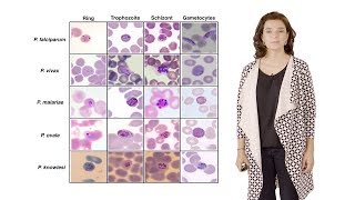 Maria Mota IMM 3 Nutrient sensing modulates malaria parasite virulence [upl. by Opportuna842]