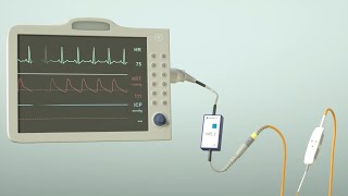 How does the parenchymal ICP measurement from RAUMEDIC work [upl. by Htabazile]