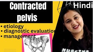 Contracted pelvis etiology Robert pelvis  Naegles pelvis  diagnosis management Hindi [upl. by Ziladnerb]