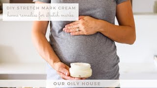 Homemade Stretch Mark Cream  Home Remedies for Stretch Marks [upl. by Thgirw]