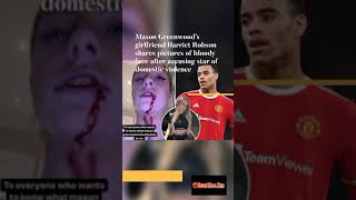 Mason Greenwood’s girlfriend shares pictures of bloody face after accusing star of domestic violence [upl. by Ary]