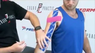 How to Apply PF Performance Tape  Bicep Tendon [upl. by Basham592]