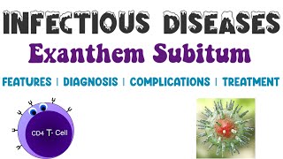 Exanthem Subitum  Viral Infections  Infectious Diseases 4  Medicine [upl. by Solracnauj943]