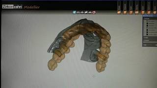 Zirkonzahn system implant type screw retained full arch Prettau [upl. by Aneladgam]