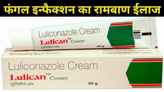 lulican cream Uses  Luliconazole Cream 1 ww uses in Hindi Fungal infection treatment [upl. by Eeral]