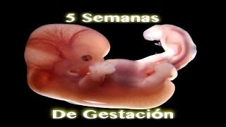 Milagro De Gestación  5 Semanas De Gestación [upl. by Layap941]