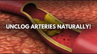 EAT These 10 HeartHealthy Foods For Your Clogged Arteries [upl. by Baerl]