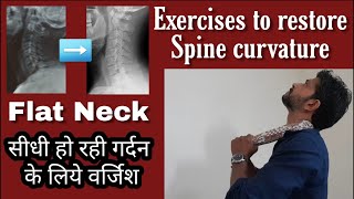 How to restore cervical curve  Exercises for straightening of cervical spineLoss of Lordosis [upl. by Ignaz200]