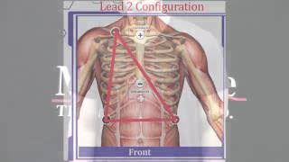 Electrode Placement Training for Electrocardiogram ECG [upl. by Wina]