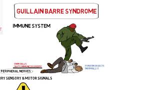 GBS Guillian barre syndrome malayalam [upl. by Gnanmos]