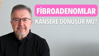 Fibroadenomlar Kansere Dönüşür Mü [upl. by Barcroft269]