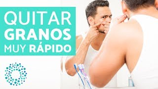 Trucos para eliminar granos de la cara rápido [upl. by Winfred273]