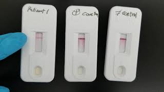 Immunology Infectious Mononucleosis Test [upl. by Shivers]