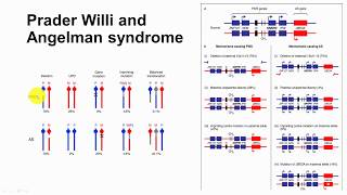 72 Impriting and Imprinting Disorders  Prader Willi and Angelman Syndroes [upl. by Plato]