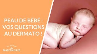 Peau de bébé  vos questions au dermato  La Maison des maternelles LMDM [upl. by Blancha]