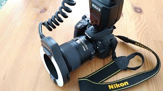 Dental Photography Settings for Nikon Camera DSLR [upl. by Okwu]