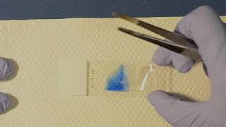 How to prepare a Scotch tape slide for fungal micromorphology assessment [upl. by Eradis209]