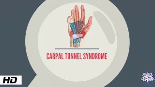 3 BEST Exercises for Carpal Tunnel Syndrome [upl. by Idoux]